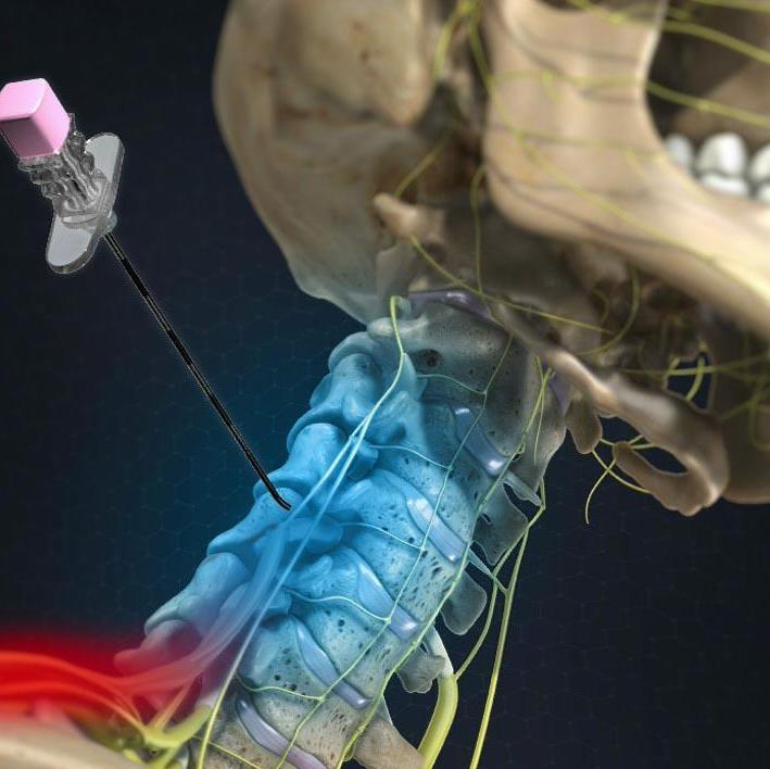 The Effectiveness of First and Repeat Cervical Facet Joint ...