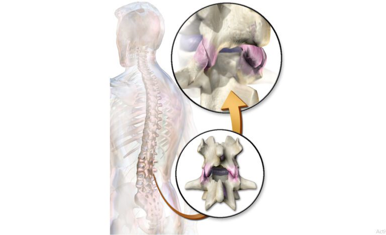 When Do You Trust Imaging Findings for Low Back Pain-1