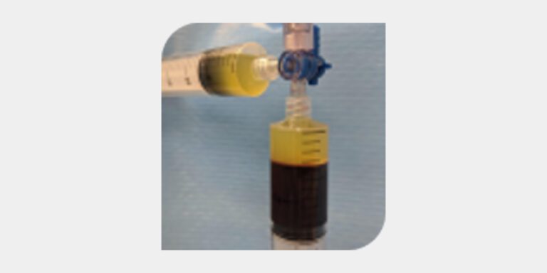 Platelet-Rich Plasma for the Neck – Maybe Not So Promising