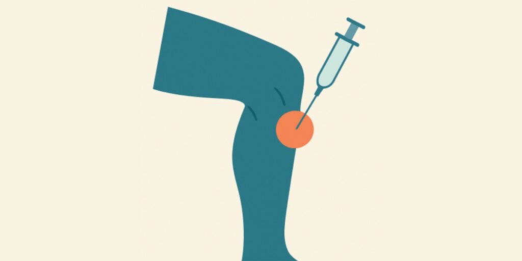 An evaluation of a low‐cost platelet‐rich plasma for osteoarthritis of the knee- a pilot study