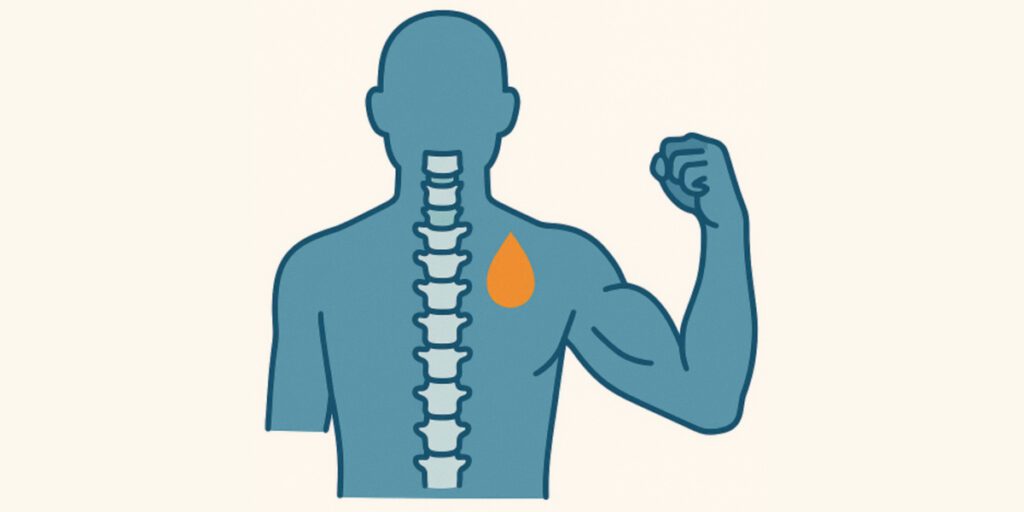 Cervical Spine Platelet-Rich Plasma and Isometric Strength Synergistically Improve Disability in Chronic Whiplash Associated Disorders A Series of Mediation Analyses