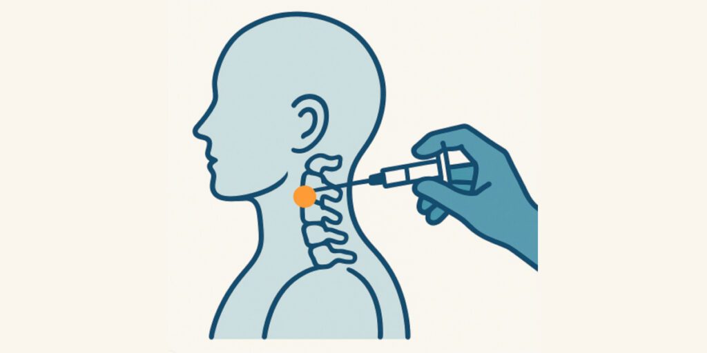 Evaluating Prognostic-Block Selection Criteria in Cervical Medial Branch Radiofrequency Neurotomy- A-Retrospective Cohort Study