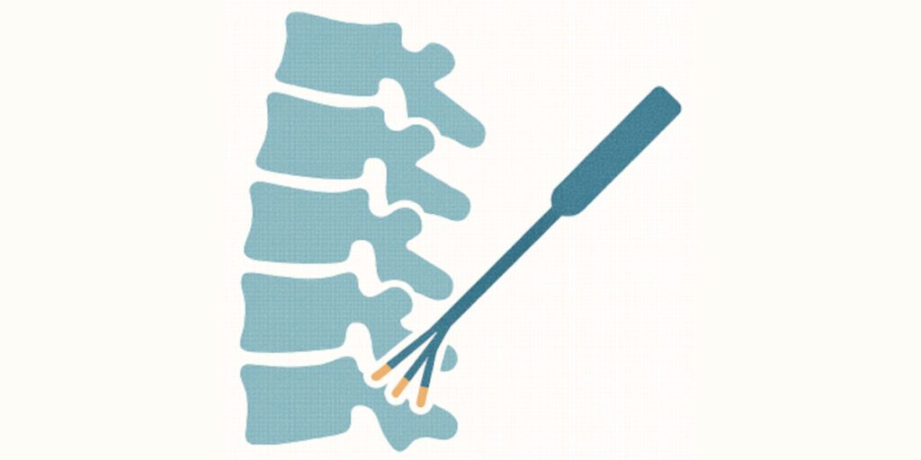 The Effectiveness-of Cervical Medial Branch Radiofrequency Neurotomy Using a Perpendicular Approach-with a Three