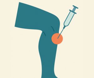 An evaluation of a low‐cost platelet‐rich plasma for osteoarthritis of the knee- a pilot study