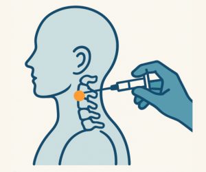 Evaluating Prognostic-Block Selection Criteria in Cervical Medial Branch Radiofrequency Neurotomy- A-Retrospective Cohort Study