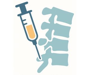Glucocorticoid facet joint injection for chronic back or neck pain