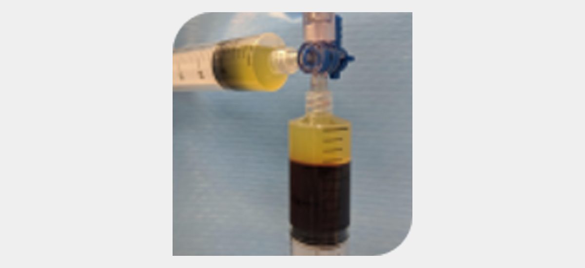 Platelet-Rich Plasma for the Neck – Maybe Not So Promising