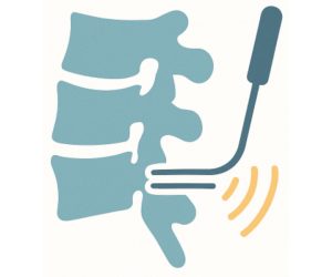 Targeting the lateral neck of superior articular process and sub-mammillary fossa for lumbar medial branch radiofrequency ablation- A case series