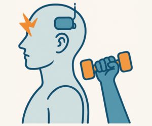 The Treatment of Cervicogenic Headache with Transcranial Direct Current Stimulation and Exercise Therapy A Randomized Control Trial Evaluating Functional Outcomes NeuroRehabilitation